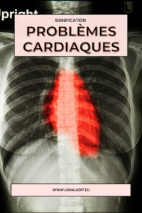 Problèmes cardiaques